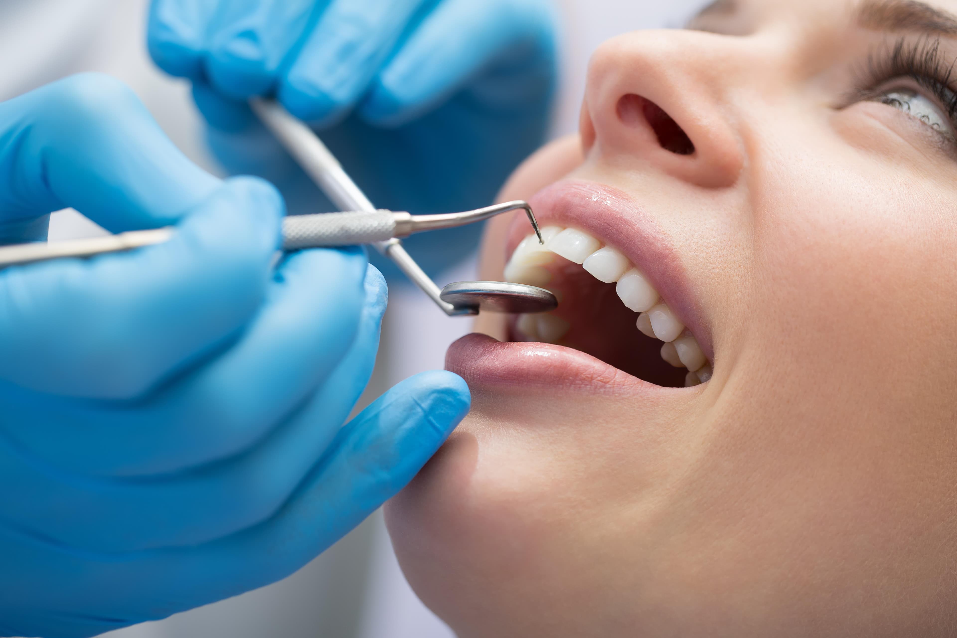 Wikibulz editorial dental cleaning image for Bareilly dentist guide